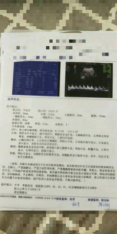 journal_insert_pic_1071374456