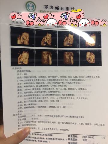 journal_insert_pic_1071924622
