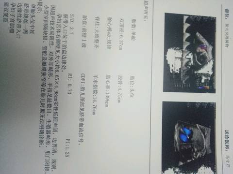 journal_insert_pic_1072732260