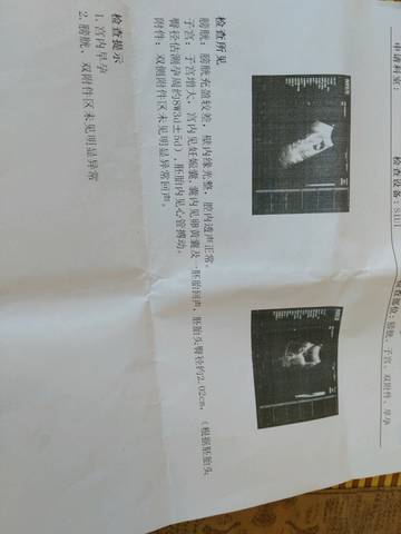 journal_insert_pic_1073168393