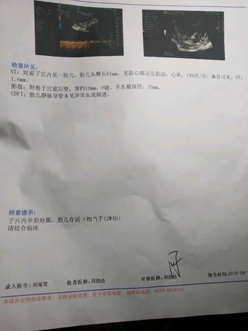 journal_insert_pic_1074272183