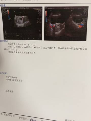 journal_insert_pic_1075933268