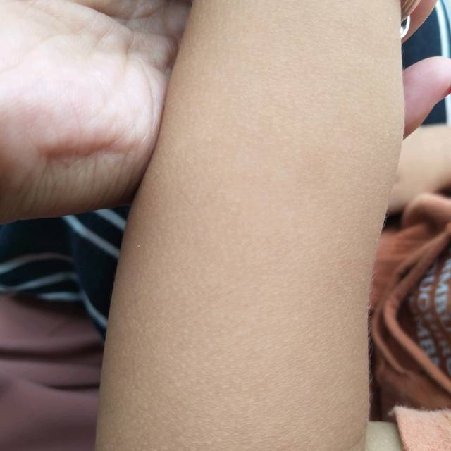 三岁小孩身上皮肤像鸡皮(三岁多宝宝皮肤像鸡皮一样)