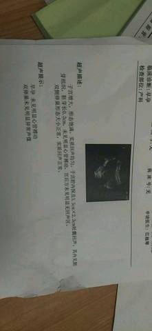 journal_insert_pic_1077609179