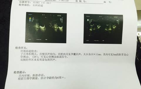 journal_insert_pic_1079440637