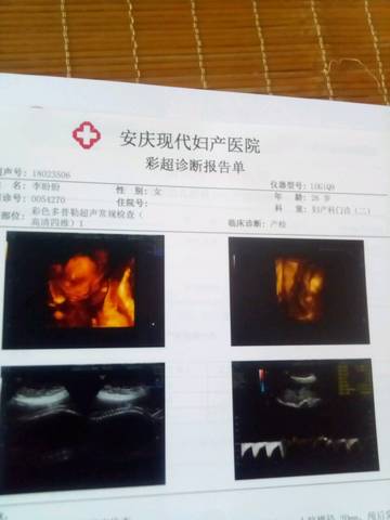 journal_insert_pic_1079771168