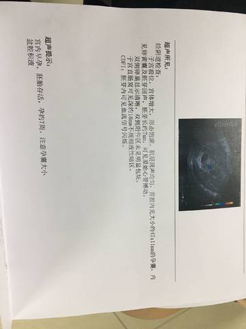 journal_insert_pic_1079903988