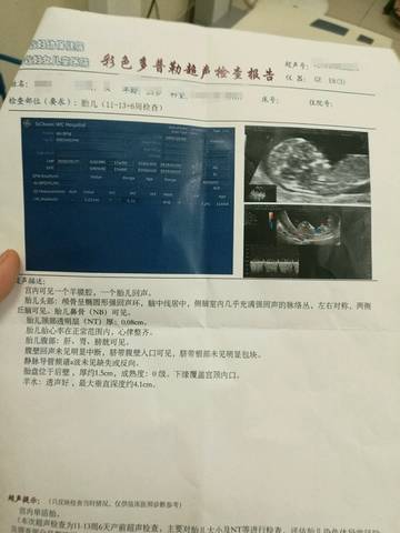 journal_insert_pic_1079872876