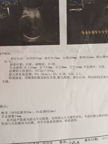 journal_insert_pic_1081894378