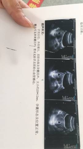 journal_insert_pic_1081854786