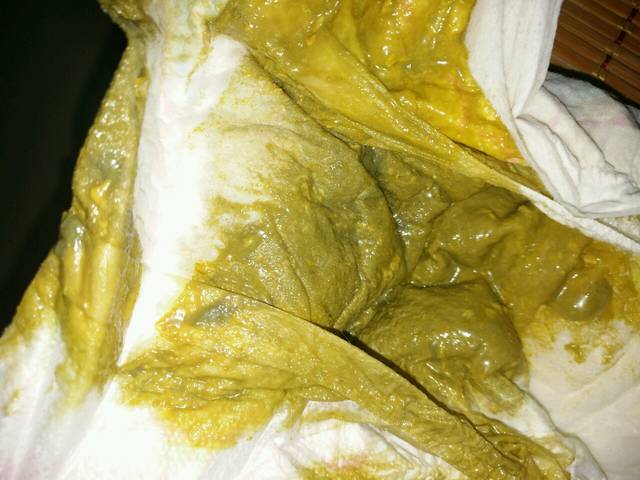 请问4个月的宝宝,大便正常吗?有图片_这段时间来小宝宝拉的便_宝宝树