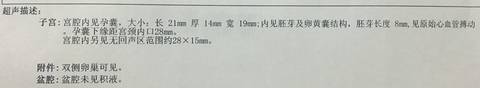 journal_insert_pic_1087241541