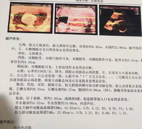 journal_insert_pic_1091985177
