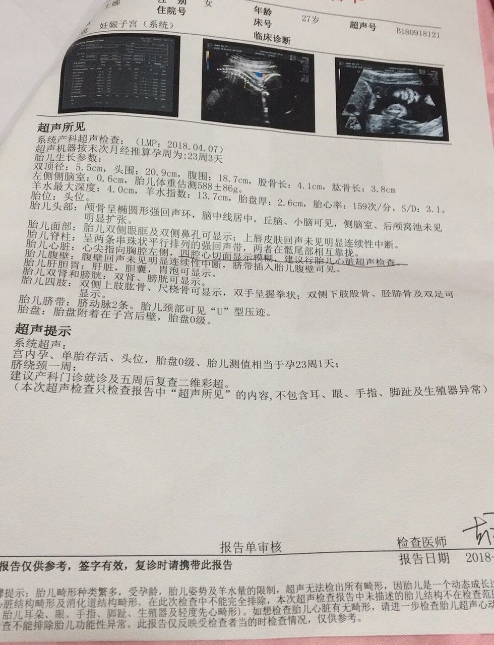 热乎乎的四维出来啦，是男是女哦😊