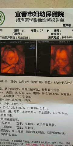 journal_insert_pic_1096215478