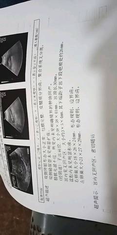 journal_insert_pic_1096245465