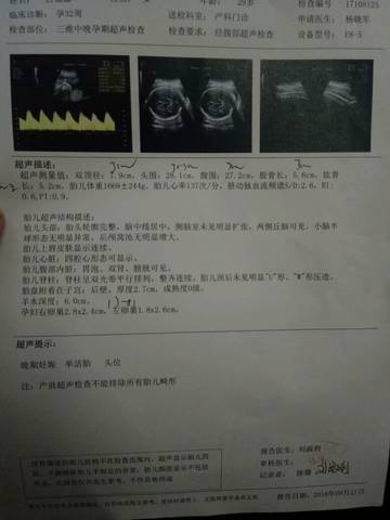 journal_insert_pic_1096840053