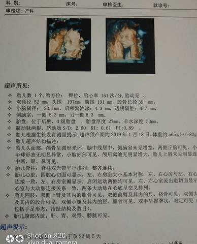 journal_insert_pic_1097172882