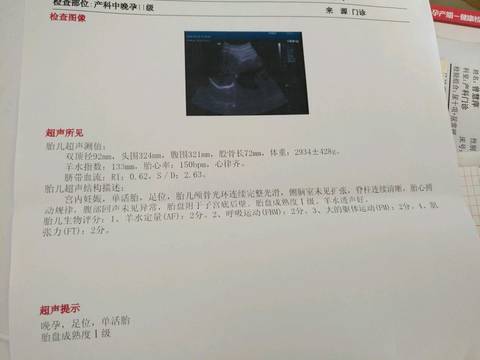 journal_insert_pic_1098946669