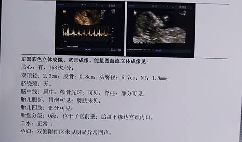 journal_insert_pic_1100101623