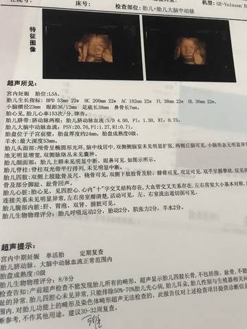 journal_insert_pic_1099724457