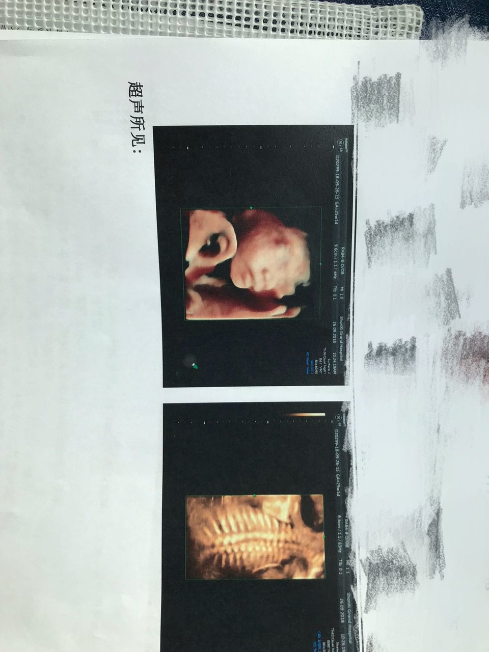 宝妈们接四维顺利通过啦