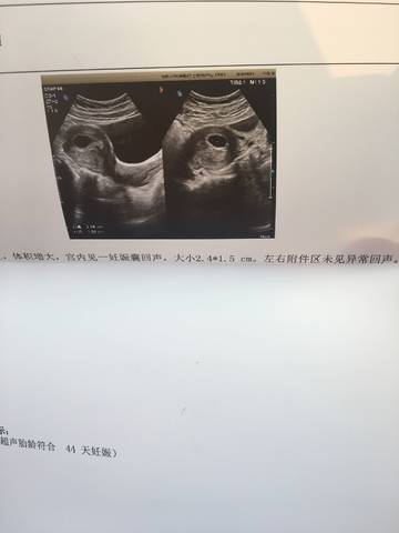 journal_insert_pic_1101053916