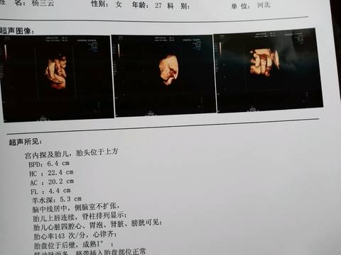 journal_insert_pic_1101118166