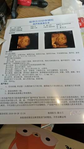 journal_insert_pic_1101047117