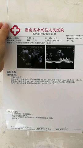 journal_insert_pic_1101632161