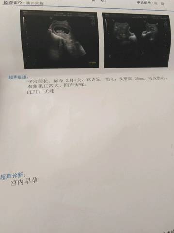 journal_insert_pic_1103210998