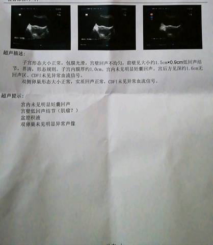 journal_insert_pic_1104015038