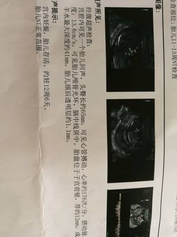 journal_insert_pic_1104977923
