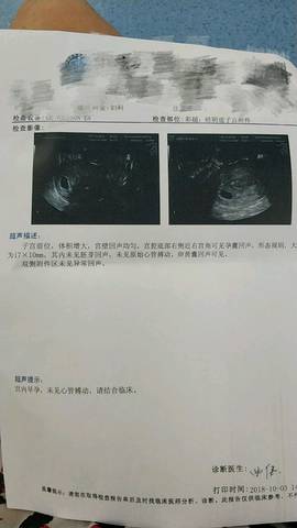 journal_insert_pic_1106919958