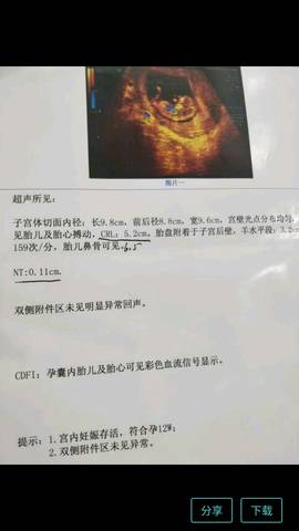 journal_insert_pic_1106720490