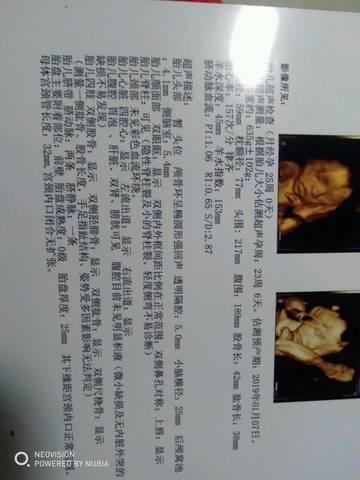 journal_insert_pic_1106776731