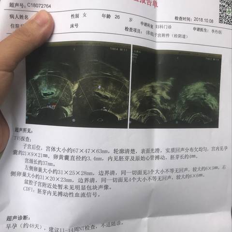 journal_insert_pic_1107849349