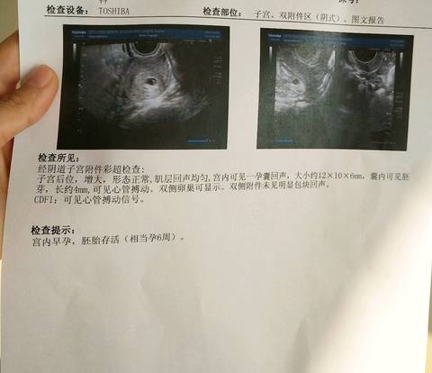 journal_insert_pic_1107953664
