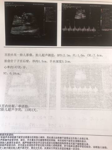 journal_insert_pic_1107672934