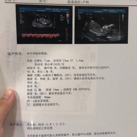 journal_insert_pic_1108061099