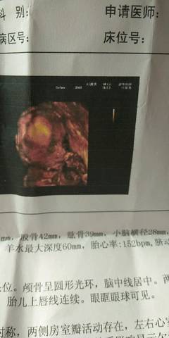 journal_insert_pic_1108768373