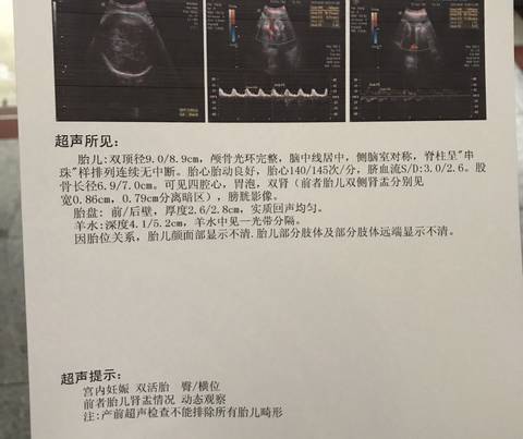 journal_insert_pic_1108434689