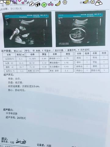 journal_insert_pic_1108772927