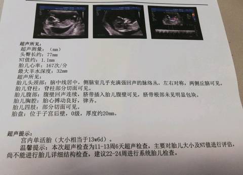 journal_insert_pic_1109399573