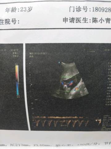 journal_insert_pic_1109266108