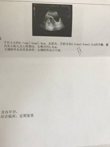 journal_insert_pic_1109250172