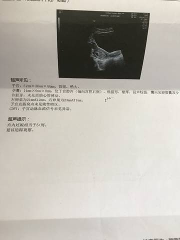 journal_insert_pic_1109250155