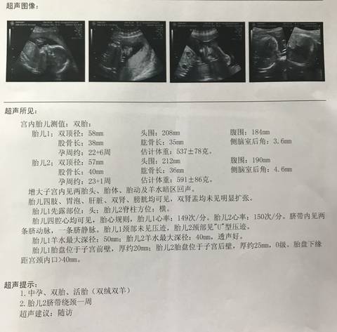 journal_insert_pic_1109838770