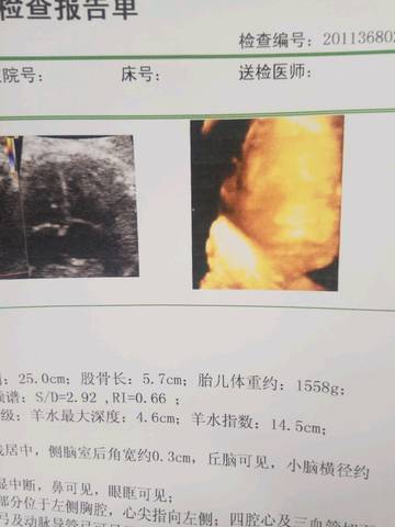 journal_insert_pic_1110042063
