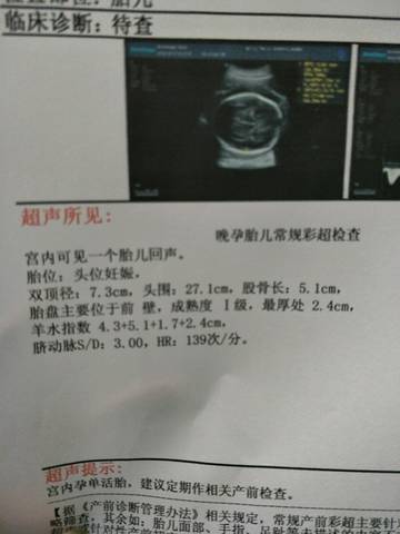 journal_insert_pic_1110433193